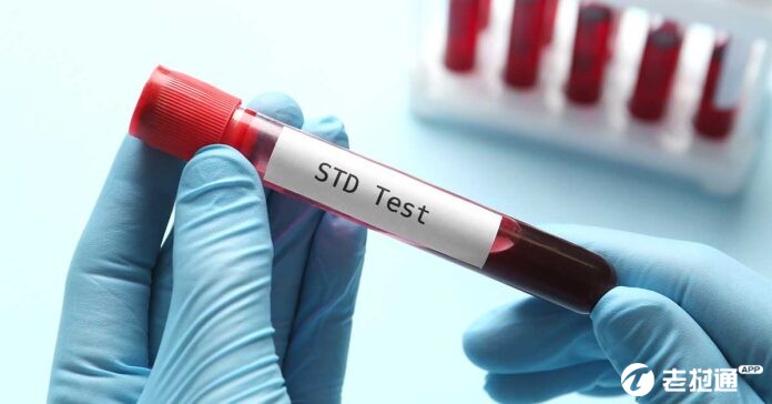 STD-Test-6-696x364.jpg